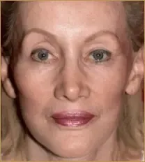 հարսնացուի կրեմ