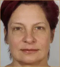 հարսնացուի կրեմ